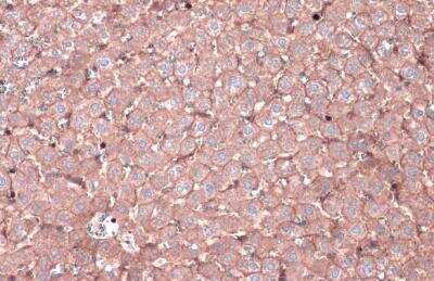 Immunohistochemistry-Paraffin: N-Cadherin Antibody [NBP2-19459]