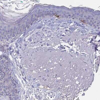 Immunohistochemistry-Paraffin: N-Cadherin Antibody [NBP2-38856]