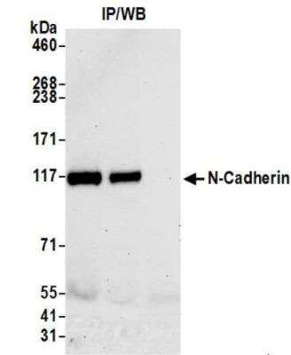 Immunoprecipitation: N-Cadherin Antibody (BLR097G) [NBP3-14690]