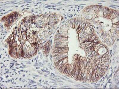 Immunohistochemistry: N-Cadherin Antibody (OTI2G7) - Azide and BSA Free [NBP2-72891]