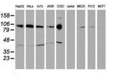 Western Blot: N-Cadherin Antibody (OTI2G7)Azide and BSA Free [NBP2-72891]