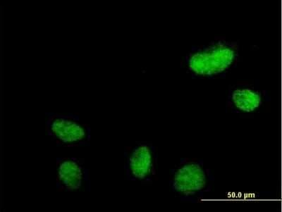 Immunocytochemistry/ Immunofluorescence: N-PAC Antibody [H00084656-B01P]