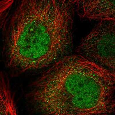 Immunocytochemistry/ Immunofluorescence: N-PAC Antibody [NBP2-38576]