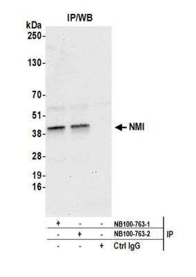 Immunoprecipitation: N myc interactor Antibody [NB100-763]