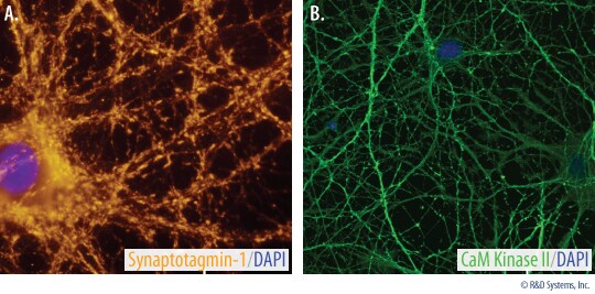 Synaptotagmin and CAM Kinase II Expression in Neurons Cultured in Media Supplemented with N21-MAX.