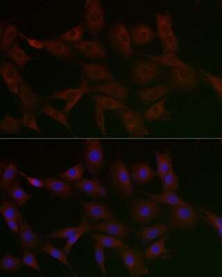 Immunocytochemistry/ Immunofluorescence: N4BP2 Antibody - Azide and BSA Free [NBP3-16022]