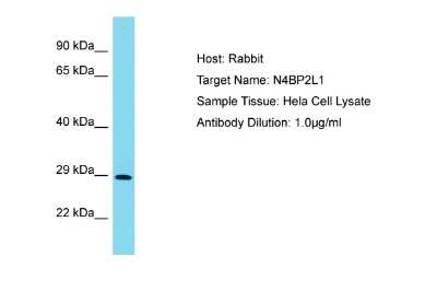 Western Blot: N4BP2L1 Antibody [NBP2-83251]