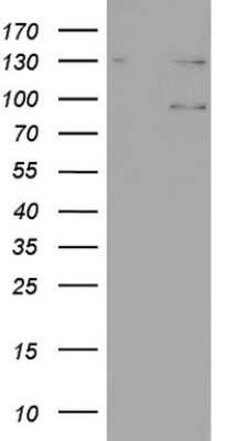 Western Blot: N4BP2L2 Antibody (OTI1C8) [NBP2-46078]