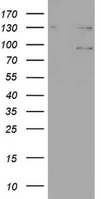 Western Blot: N4BP2L2 Antibody (OTI1C8)Azide and BSA Free [NBP2-72866]