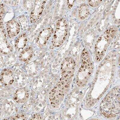 Immunohistochemistry-Paraffin: N4BP3 Antibody [NBP1-91019]