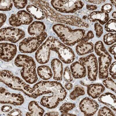 Immunohistochemistry: N4BP3 Antibody [NBP2-48511]
