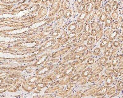 Immunohistochemistry-Paraffin: N4BP3 Antibody [NBP3-12669]