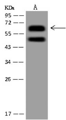 Western Blot: N4BP3 Antibody [NBP3-12669]