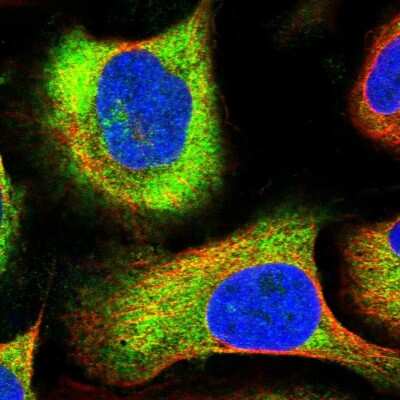 Immunocytochemistry/ Immunofluorescence: NAA10 Antibody [NBP2-33934]