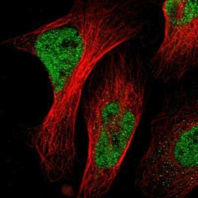 Immunocytochemistry/ Immunofluorescence: NAC1 Antibody [NBP1-89991]