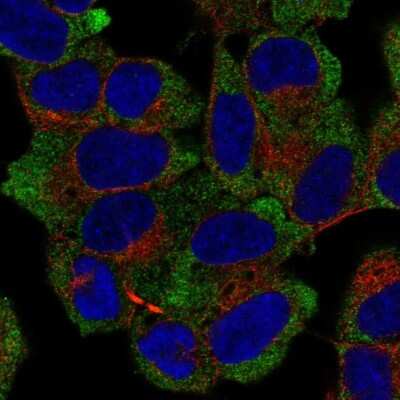 Immunocytochemistry/ Immunofluorescence: NACA1 Antibody [NBP2-57988]