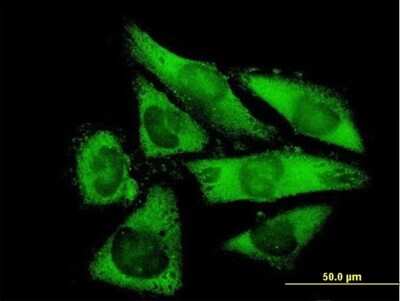 Immunocytochemistry/ Immunofluorescence: NACA2 Antibody [H00342538-B01P]