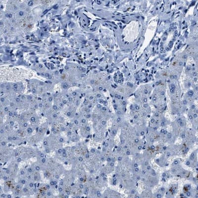Immunohistochemistry-Paraffin: NACAD Antibody [NBP2-47363]
