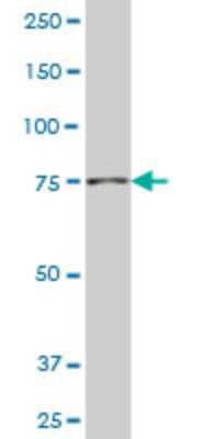 Western Blot: NAD Synthetase Antibody (4G9) [H00055191-M01]