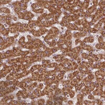 Immunohistochemistry: NADKD1 Antibody [NBP2-49337]