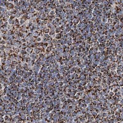 Immunohistochemistry-Paraffin: NADKD1 Antibody [NBP2-48680]