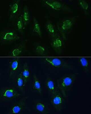 Immunocytochemistry/ Immunofluorescence: NAG Antibody - BSA Free [NBP2-93277]