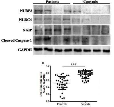Western Blot: NAIP AntibodyBSA Free [NBP1-77196]