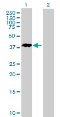 Western Blot: NANOGP8 Antibody [H00388112-B01P]