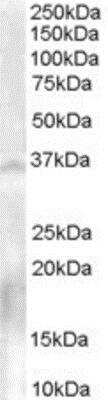 Western Blot: NANOS1 Antibody [NB100-1781]