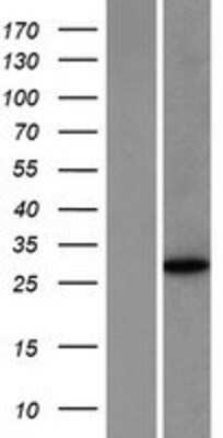 Western Blot: NANOS1 Overexpression Lysate [NBP2-04615]