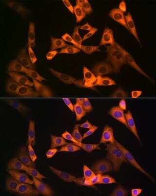 Immunocytochemistry/ Immunofluorescence: NAP1L1 Antibody (4W8B6) [NBP3-16633]