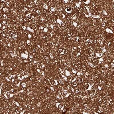 Immunohistochemistry-Paraffin: NAPA Antibody [NBP2-33593]