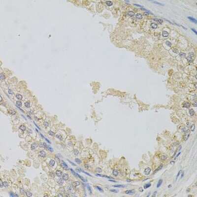 Immunohistochemistry-Paraffin: NAPA Antibody - BSA Free [NBP2-95104]