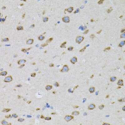 Immunohistochemistry-Paraffin: NAPA Antibody - BSA Free [NBP2-95104]