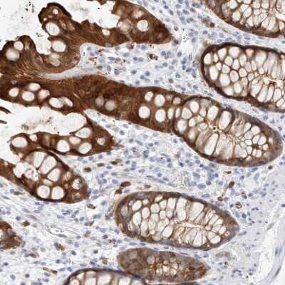 Immunohistochemistry-Paraffin: NAPE-PLD Antibody [NBP2-48571]