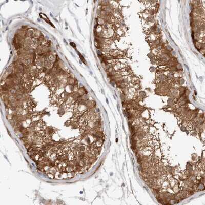 Immunohistochemistry-Paraffin: NAPE-PLD Antibody [NBP2-48571]