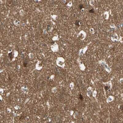 Immunohistochemistry-Paraffin: NAPG Antibody [NBP1-86491]