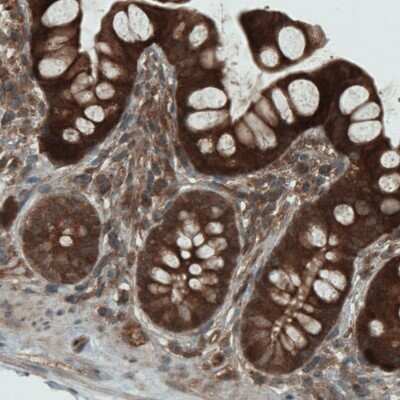 Immunohistochemistry: NAPRT1 Antibody (CL0366) [NBP2-52924]