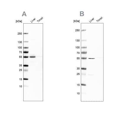 Western Blot: NAPRT1 Antibody [NBP1-87243]