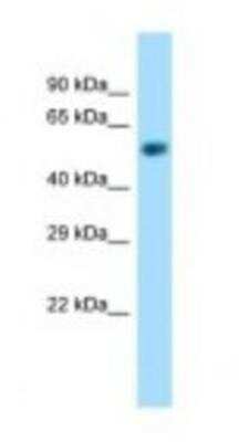 Western Blot: NAPRT1 Antibody [NBP1-98433]