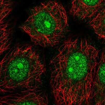 Immunocytochemistry/ Immunofluorescence: NARF Antibody [NBP2-55660]