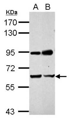 Western Blot: NARF Antibody [NBP2-19475]