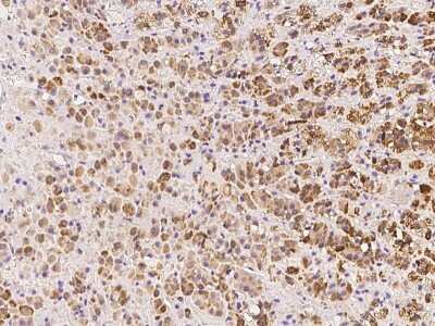 Immunohistochemistry-Paraffin: NARFL Antibody [NBP3-06258]