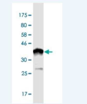 Western Blot: NARG1 Antibody (4A11) [H00080155-M01-100ug]