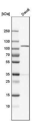 Western Blot: NARG1 Antibody [NBP1-92165]