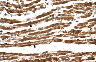 Immunohistochemistry-Paraffin: NARG1L Antibody [NBP1-53124]