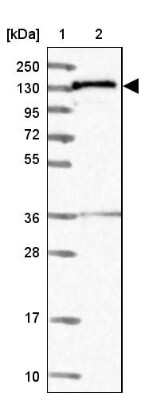 Western Blot: NARG1L Antibody [NBP1-92167]