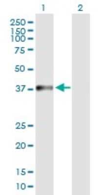 Western Blot: NARG2 Antibody [H00079664-B01P]