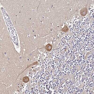 Immunohistochemistry-Paraffin: NARS Antibody [NBP2-13640]