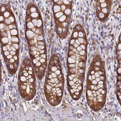 Immunohistochemistry-Paraffin: NARS Antibody [NBP2-13640]
